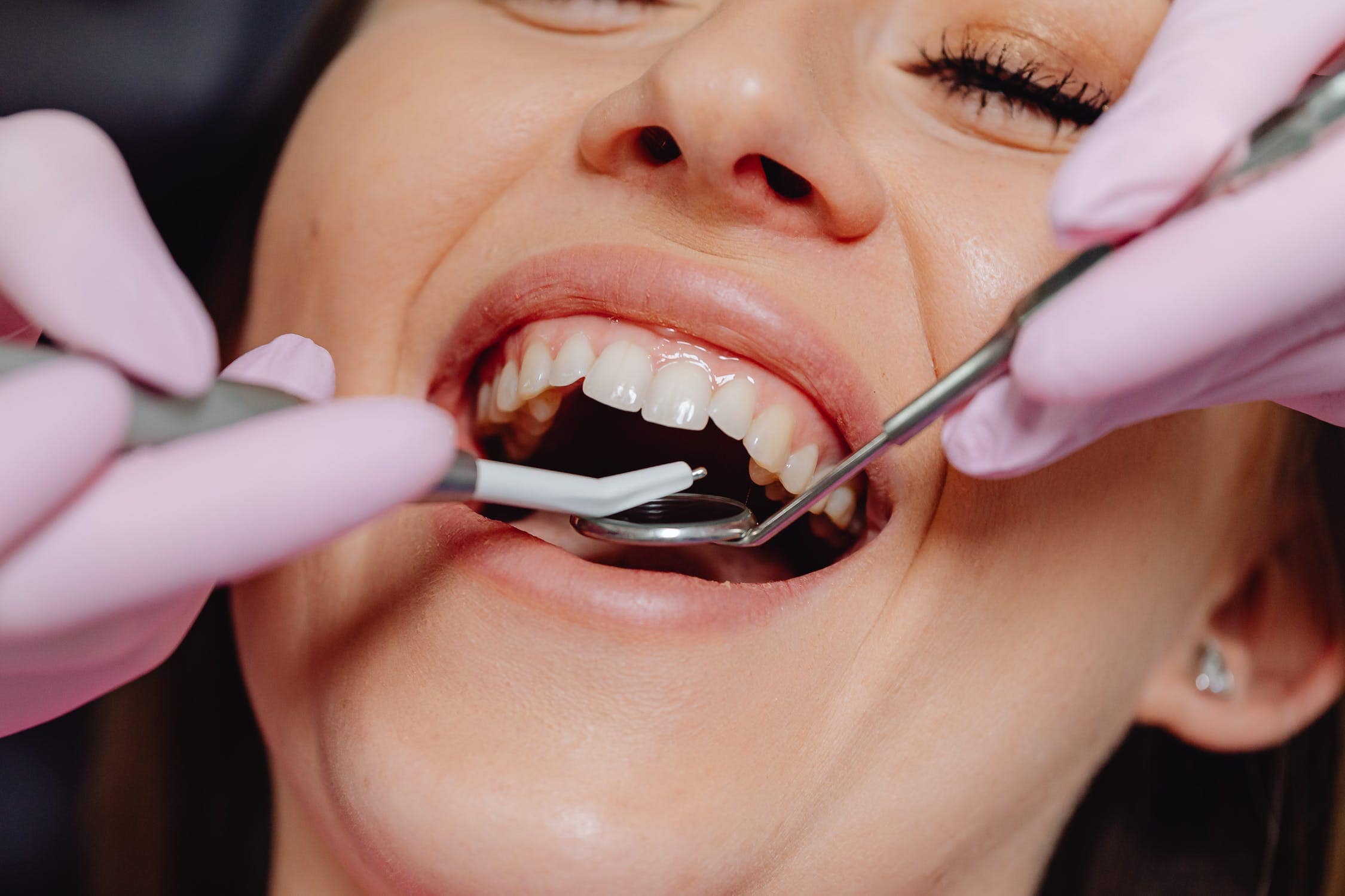 Periodontal Surgery